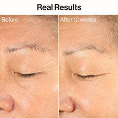 Ageless Firm + Even Serum